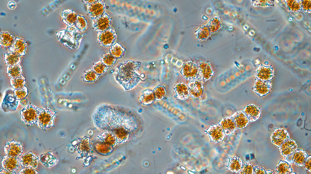 Algblomning genom ett mikroskop